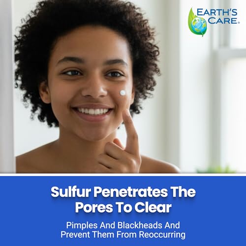 Earth's Care Acne Spot Treatment - 10% Sulfur Cream Medication to Clear Cystic Acne, Pimples and Blackheads on Face and Body (Tube 0.97 OZ)