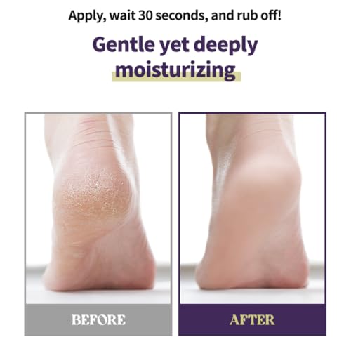 Foot Callus Remover Home Care Set ? Professional Stainless Foot File & Scrubber, Exfoliating Serum for Smooth Skin, Effective on Wet and Dry Feet