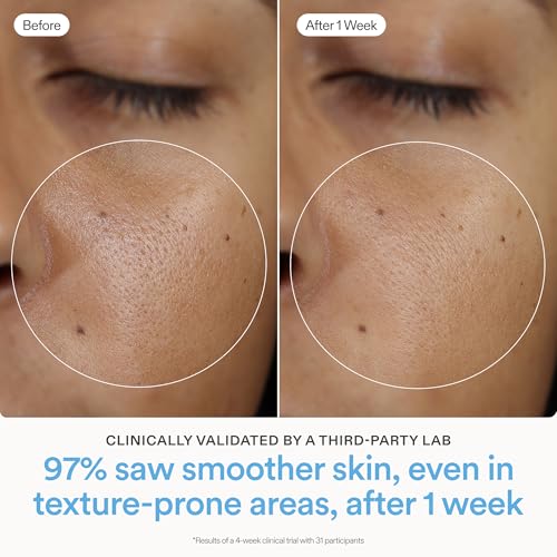 Skinfix Ceramide Prime Whipped Cream - 1.7 oz - Lightweight Moisturizer for Face with Niacinamide + Peptides - Non-Comedogenic, Fragrance Free, Vegan, Cruelty Free