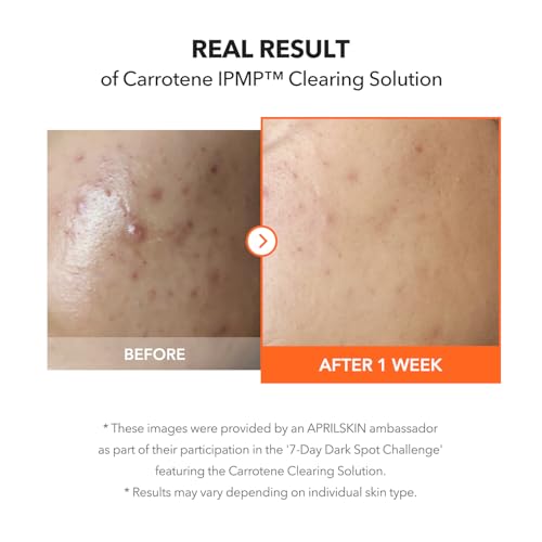 APRILSKIN Carrotene IPMP¢â Clearing Solution || Quickly soothes troubled areas and helps clear blemishes | Formulated with BHA, AHA, Niacinamide & Zinc Oxide | Vegan, Cruelty-Free (0.67fl.oz.)