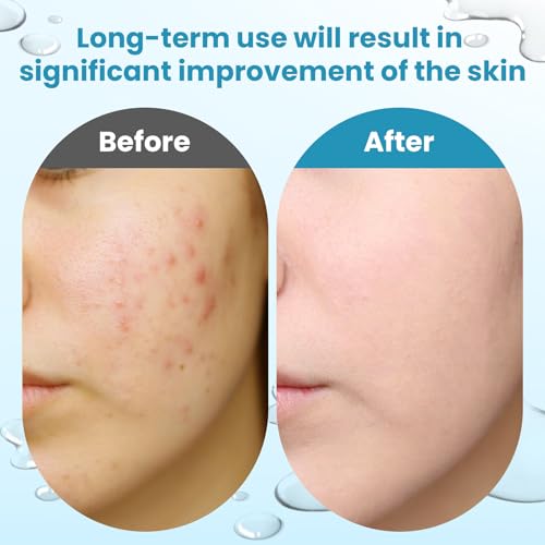 Glycolic Acid Resurfacing Pads, 15% Ultra Pure Glycolic Acid & 2% Salicylic Acid Exfoliating Peel for Face, Keeps Skin Smooth and Prevents Wrinkles and Lines, Radiant Skin Renewal - 60 Pads