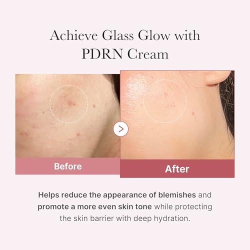 medicube Salmon DNA PDRN Pink Hyaluronic Moisturizing Cream | Blemish Relief & Hydrating Care | Restores Skin Elasticity & Glow | Korean Skincare, Even Skin Tone & Pore Care | 50ml / 1.69 fl.oz.