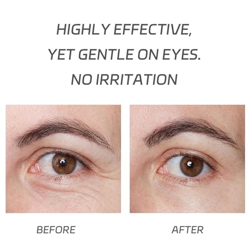VGO Eye Cream 2% Pro-Xylane Eye Repair Cream for Dark Circles & Puffiness Under Eyes, Pro Xylane + 6D Hyaluronic Acid to Firm Skin, Reduce Wrinkles, Fine Lines, 15g/0.5 Oz