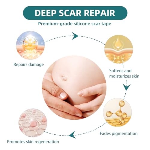 Silicone Scar Gel Sheets: Medical Grade Scar Tape for C Section Surgical Tummy Tuck Keloid Treatment?Scar Removal for Face and Skin