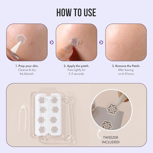 Magnesium Blemish Microdarts | Pimple Patch | Cystic Acne | Fast-Acting | Quick Calming | 99.9% Pure Magnesium | Madecassic Acid | Tea Tree | Eucalyptus Leaf | Hydrocolloid Spot Care