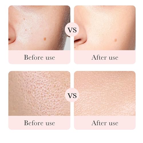 Rose Day Face Cream with Natural Rose Oil, Rose Moisturizing Cream with Hyaluronic Acid, Moisturizing and firming Face Cream, Rose Water Revitalizing Day Cream, Face Moisturizer for dry skin