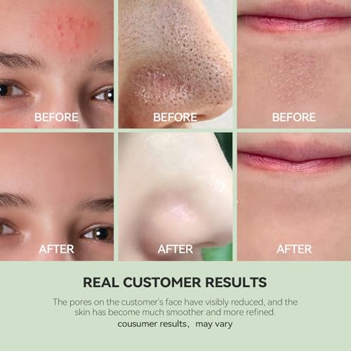 WNP Duo Cleansing Clay Mask with Niacinamide & Hyaluronic Acid ? Deep Pore Cleanser for T-Zone & U-Zone, Blackhead Remover, Hydrating & Oil-Control Face Mask, 3.53oz