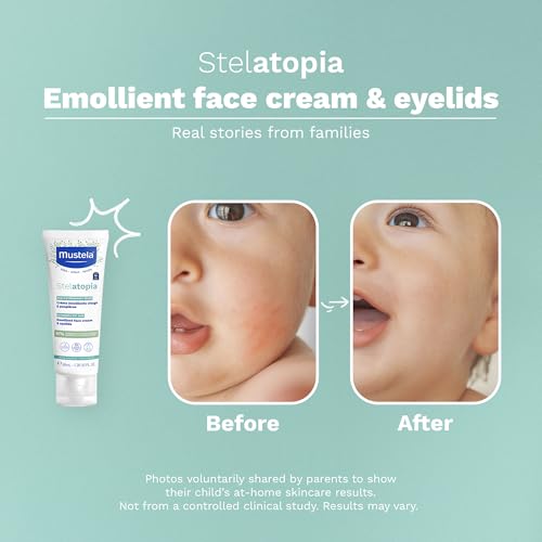 Mustela Stelatopia Eczema-Prone Skin Emollient Baby Face Cream - Face Moisturizer with Natural Avocado & Sunflower Oil - Fragrance-Free - 1.35 Fl Oz (Pack of 1)