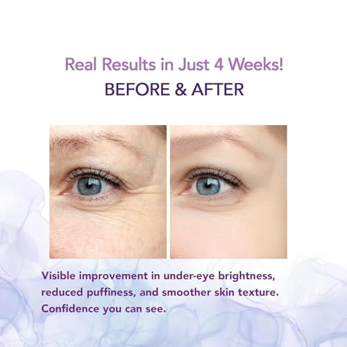 Caffeine Eye Cream for Under?Eye Hydration, Puffiness & Tired?Looking Eyes ?Lightweight Cooling Eye Balm with Caffeine, Peptides & Retinol ? Gentle Daily Formula for Men & Women (15ml x 2)