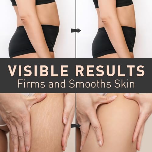 Enaskin Naturals Belly Firming Cream: B Flat Skin Tightening, Cellulite & Stretch Mark Reduction Cream for Stomach, Thighs and Booty - Hydrating Body Lotion for Women & Men - Orange 100 mL