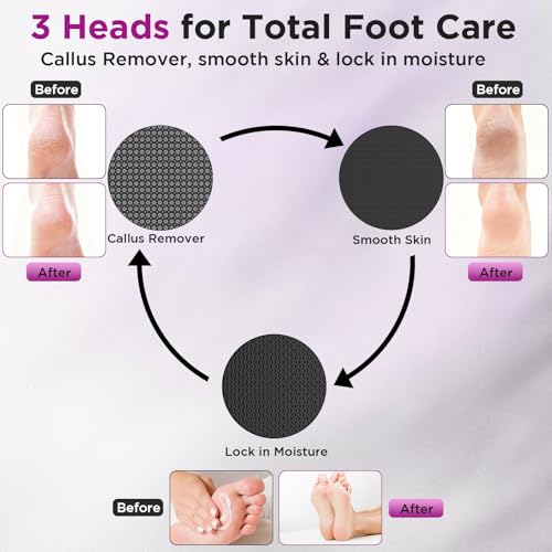 Electric Callus Remover, Apply Oil,Foot SPA,Electric Foot File,Reusable Nano-Glass Head, Ergonomic Premium Aluminum Callus Remover for feet, Rechargeable Pedicure Tools for Feet,Gifts for Men Women
