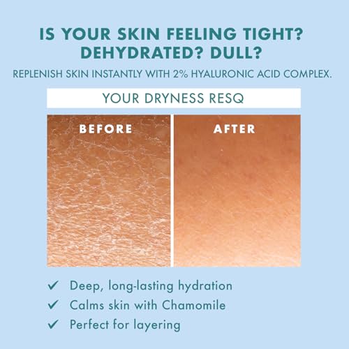 Skin ResQ by Petal Fresh Hello Hydration Serum, Hydrating Facial Serum with 2% Hyaluronic Acid Complex and Chamomile, Fragrance Free Moisturizing Serum for Dry Sensitive Skin, Made in Korea, 2 oz
