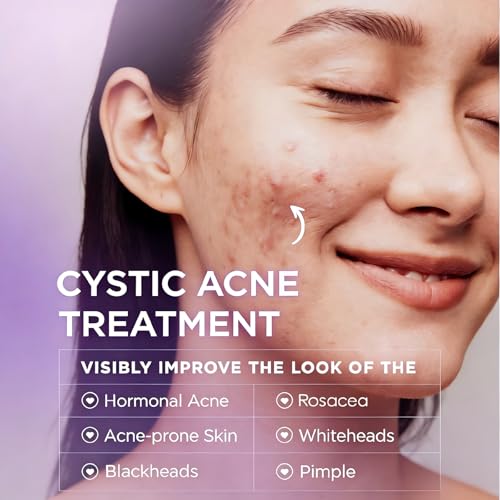 Nip + Fab Glycolic Fix Night Pads Extreme (60 Count) ? 5% Glycolic Acid Exfoliating Face Pads with Salicylic Acid ? Resurfacing AHA BHA Chemical Peel for Blemishes & Texture