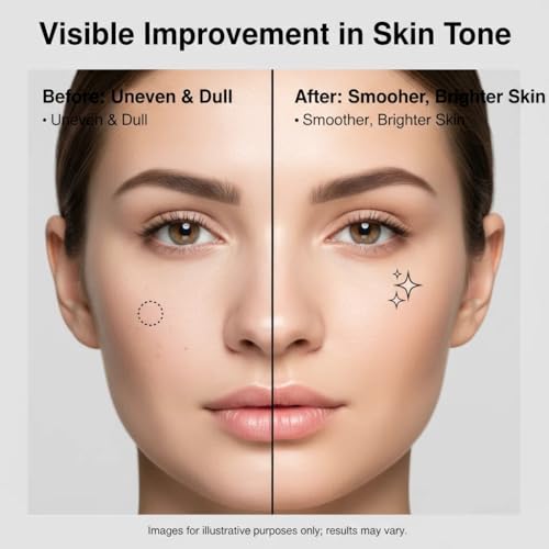 Dark Spot Remover for Face and Body Serum: Advanced Formula Spot Corrector Cream with Niacinamide £¬Age Spot Sun Spot Freckles Melasma Brown Spot - for Women and Men (1.0 Fl Oz)