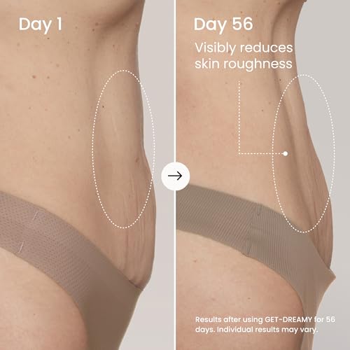 MA?LYS GET-DREAMY Overnight Toning Whip - Cellulite Cream & Skin Tightening Support with Milk Thistle + Uva-Ursi - Moisturizing Body Cream in a Whipped Texture (6.8 Fl Oz)
