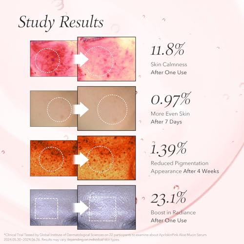 APRILSKIN Pink Aloe Mucin Serum 1.01 fl.oz (30ml) Hydrating 78% Jeju Aloe Mucin Formula with Non-Sticky Finish for a Glass Glow Look, Korean Skincare