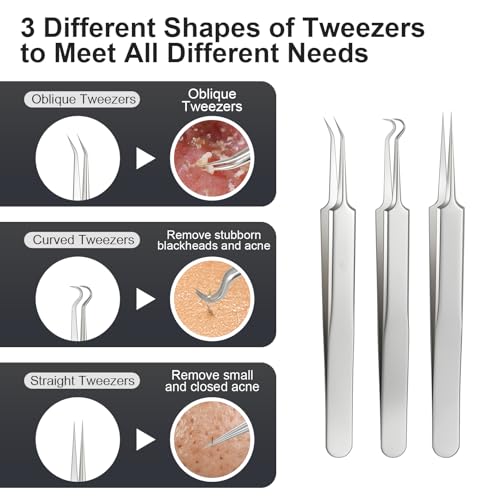 Titanium Alloy Pimple Popper Tool kit Blackhead Remover Comedone Extractor Kit with Box for Easily Remove blackheads, Acne, Blemishes, Whiteheads, pimples and Papules from The face and Bonus Gift