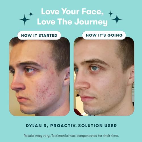 Proactiv 3 Step Acne Treatment w/ Pimple Patches - Benzoyl Peroxide Face Wash, Repairing Acne Spot Treatment for Face and Body, Exfoliating Toner - 90 Day Complete Acne Skin Care Kit + Pimple Patches