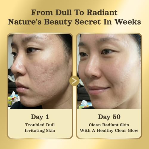 ASSI'S K-BEAUTI Natural Soap with Garlic Enzyme, Deep Cleansing, Face Wash for Radiant Looking Skin, Korean Skincare, Botanical Soap Bar for Face Made in Korea, 3.5 oz