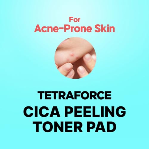 Elishacoy | TETRAFORCE Cica Peeling Toner Pads, Gentle Exfoliating & Calming Toner with Cica, Daily Skin Smoothing & Hydration, Vegan & Dermatologist Tested, 150 mL