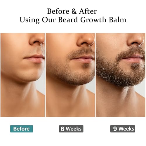Estimulante Para Barba ? B?lsamo de Crecimiento Ultra Potente, Beard Stimulating Balm, Moisturizes & Strengthens Beard, 100 ml / 3.5 oz