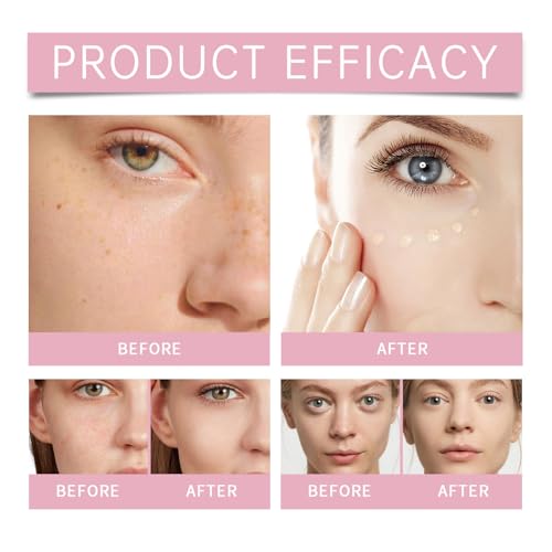 Under Eye Brightener Concealer, Dark Circle Concealer & Brightener, Moisturizing & Waterproof (Natural colour)