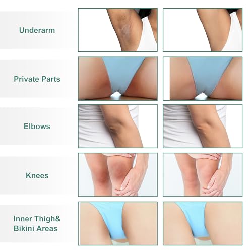 Curology Gentle Facial Cleanser, Hydrating Foaming Face Wash, for Sensitive, Dry or Oily Skin Types, 5 fl oz