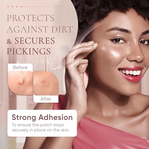 Zing Prime Clear Hydrocolloid Pimple Patches for Face, Acne Dots & Zit Stickers, Strong Adhesion Blemish Patch, Made in Korea, Vegan (45 Count)