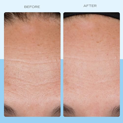 First Aid Beauty - Firming Collagen Cream with Peptides + Niacinamide, Ultra Rich Skin-plumping Moisturizer, Hydrates & Helps Visibly Firm Skin, Non-Comedogenic, Safe for Sensitive Skin, 1.7 oz