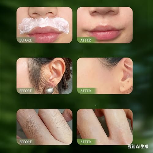 Hair Remover Cream for Face- Trilogy Kit