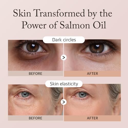 eyeNlip Salmon Peptide Eye Cream 1.18 fl oz - Daily Lightweight Cream with Niacinamide and Nutrition-Rich Complex for a Refreshed Under-Eye Look, Korean Skincare Routine