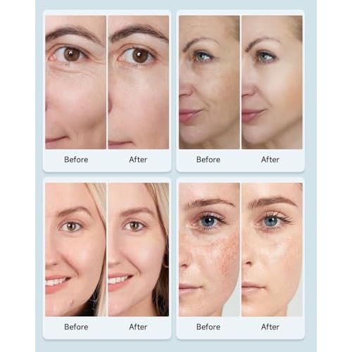 Deoproce SYN-AKE Intensive Wrinkle Care Cream 100g ? Brightening & Smoothing Facial Moisturizer with Peptide, Niacinamide & Adenosine ? Hydrating Korean Skin Care ? Made in Korea