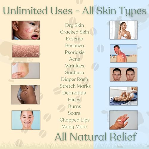 Beef Tallow for Skin | NAKED TALLOW BALM | 1 Ingredient - 100% Grass Fed Beef Tallow | Beef Tallow for Body & Face | Whipped & UNSCENTED for Sensititve Dry Skin, Babies, Eczema, Psoriasis