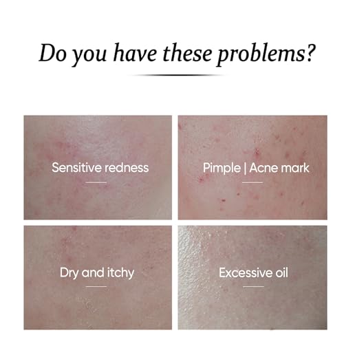 Amino Acid Face Wash with Brush,Foaming Facial Cleanser for Sensitive Skin,Oil-Free Pore Face Cleanser for Women & Men