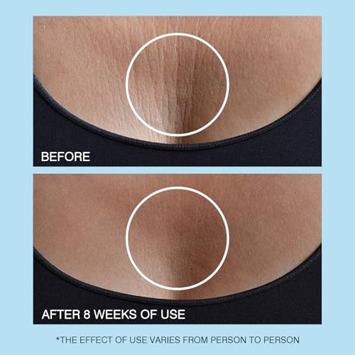 Retinol Neck Cream - Hyaluronic Acid & Caffeine Enriched Neck Firming Cream | Anti-Aging 3-in-1 Moisturizing Cream to Minimize Fine Lines, Dullness & Sagging Skin for Neck, Chest & Face (50ml/1.7oz)