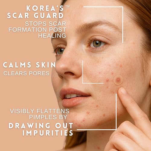 Original Korean Hydrocolloid Acne Pimple Patches, Spot Cover Stickers Absorb Pus, Shrink Pimples & Whiteheads, Scar-Guard Formula (K-Perfect Everyday Thin Pack, 56 Count, 3S)
