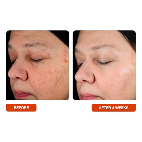 BeautyStat Universal C Serum ? 20% Pure Vitamin C with Collagen-Boosting Peptides and Hyaluronic Acid to Brighten, Firm, and Strengthen Skin (30ml)