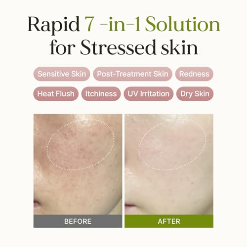 7 Relief Ampoule Pad (100 pads) ? Quick Calming & Soothing Serum-Infused Toner Pads with 7 Herbal Blend, Moisturizing Comfort for Stressed and Sensitive Skin | Family-Friendly, Korean Skincare