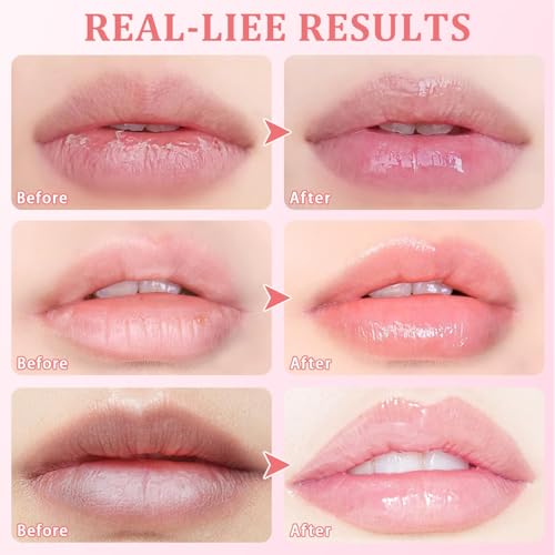 3 Pcs Bee Balm,Honey Strawberry Watermelon Bee Lip Balm Honey Pot,Moisturizing Lip Mask Overnight,Hydrate Repair Prevent Dry Cracked Lip Care (Honey+Strawberry+Watermelon)
