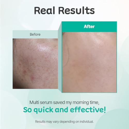 KIFT Multi-Solution Face & Eye Serum - Hydrating, Smoothing, and Soothing K-Beauty Skincare Serum for Radiant, Nourished Skin, 30ml