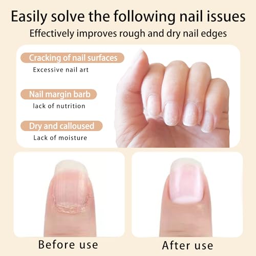 28PCS Cuticle Oil Pen Sweet Almond Nail Growth Serum and Repair Treatment Hydrating Oil for Dry Cuticles and Skin Cuticle Buddy Revitalize Nails with Radiant Cosmetics' Nail Growth Oil