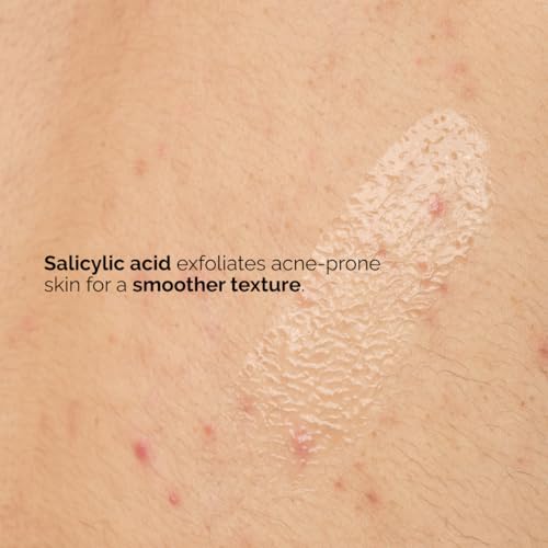The Ordinary Salicylic Acid 0.5% Body Serum, Exfoliating Treatment for Acne-Prone Skin, 8.1 Fl Oz