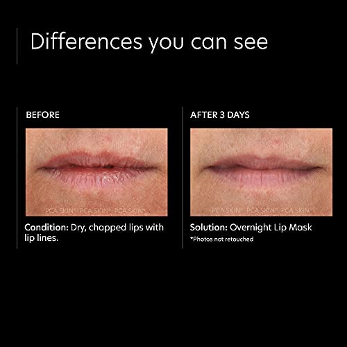 PCA SKIN Overnight Lip Mask ? Ultra Hydrating Nighttime Mask Treatment to Nourish Lips (0.46 oz)
