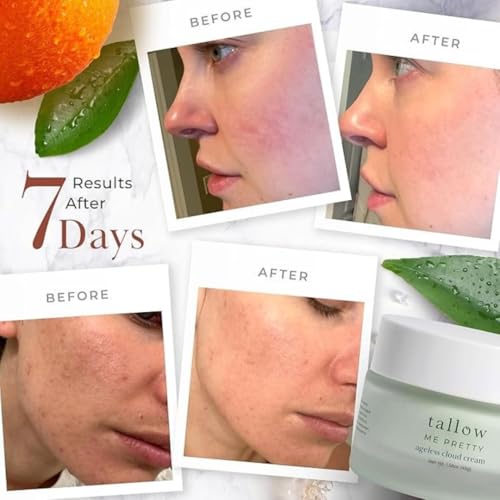 Ageless Cloud Cream, Powerful Nourishing Face Cream for Women, Improves Overall Texture & Boosts Skin Elasticity, Powered by Essential Fatty Acids, 1.58 Oz
