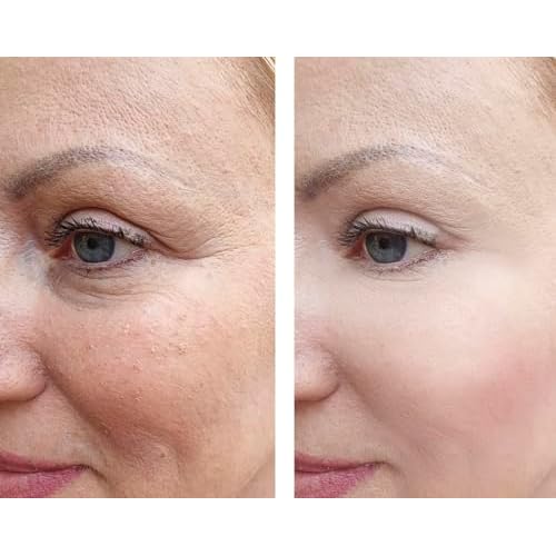 Vitality Precision Skin Phloretin C Serum