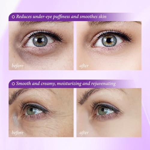 Eye Cream, Reduce Wrinkles and Fine Lines, Moisturizing, Pro-Xylane Active Anti-Wrinkle Eye Cream, Eye Care