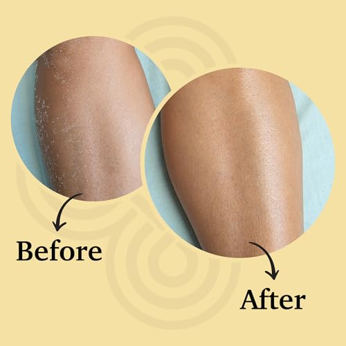 ORBE Derma Solutions Orbe It! 2-Step Acne Treatment ? Clears, Treats & Prevents Acne & Helps Unclog Pores with 2% Salicylic Acid ? Includes Cleansing Spray 1 oz & Treatment Cream 1 oz