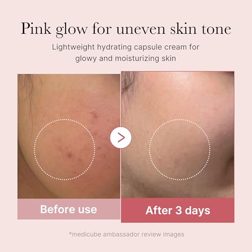 Nonie AHA Protein Moisturizer for Dry Skin Rejuvenating Protein Cream with Alpha Hydroxy Acids 100% Natural & Vegan Ingredients Gentle USA Made