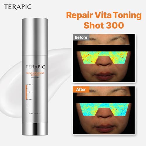 Repair Vita Toning Shot 300 ? Korean Brightening Serum with Micro EC-Spicule ? Clinically Tested for Pore Refinement, Melasma Reduction & Skin Radiance (50ml)