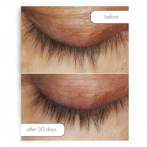 Serious Skincare Lash Bath & Conditioner - Double Action Eye Makeup Remover - Oil Free - Enhancing Peptides Promotes Eyelash Growth - Clover Flower - Effortlessly Removes Waterproof Mascara - 4 oz.